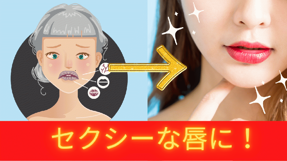 びびあん