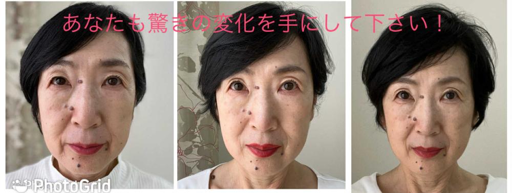 小畑佳子