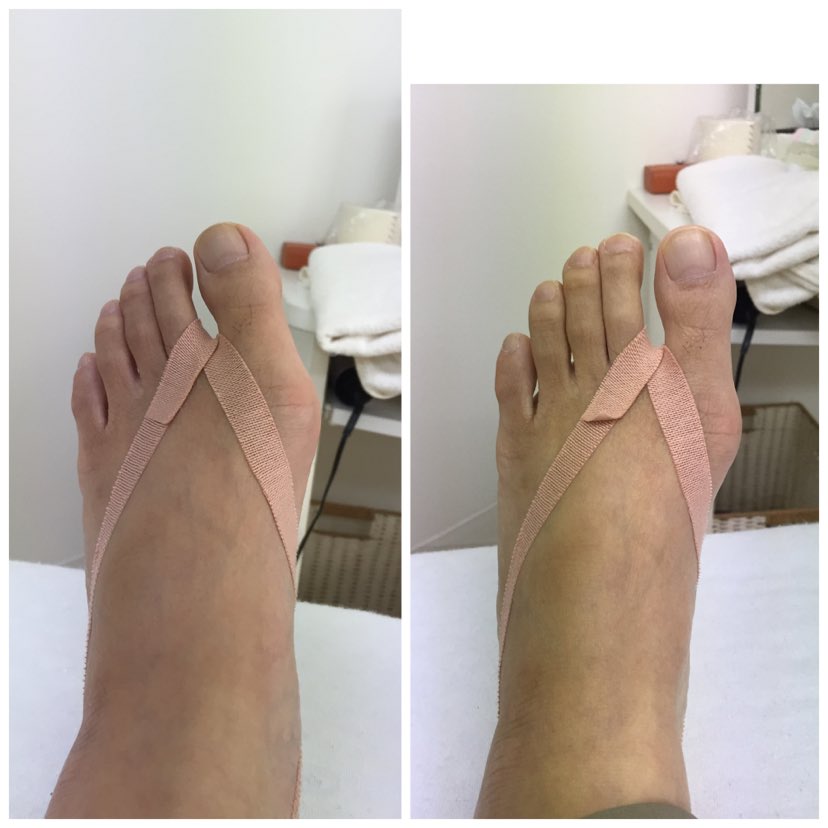 小畑佳子